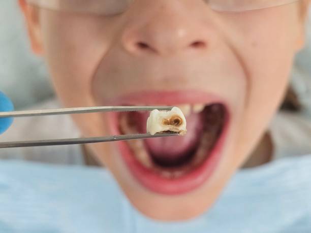 Best Walk-In Emergency Dentist in Pekin, IL